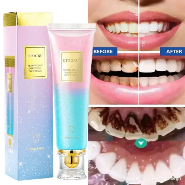 UTOGRU Nicotinamide Whitening Toothpaste – Mint Fresh Breath Toothpaste for Brighter Teeth & Oral Care