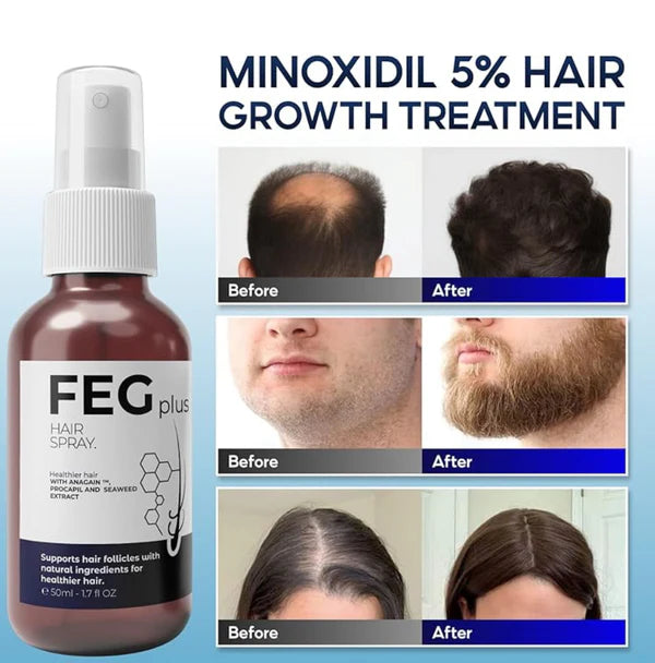 FEG Hair Growth Spray Fuller Hair (50ml)