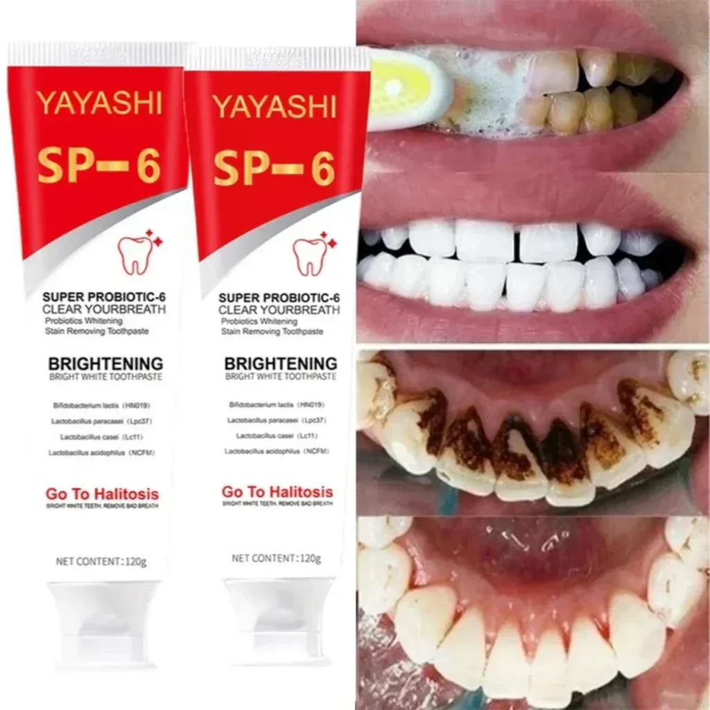 YAYASHI SP-6 Ultra Whitening Toothpaste – Super Probiotic Formula for Stain Removal, Fresh Breath & Bright White Teeth (120g)