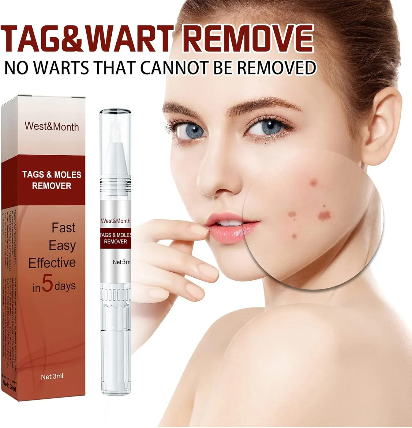 Jaysuing Liquid Wart Flat – Advanced Wart Remover for Face, Hands & Body (20ml)