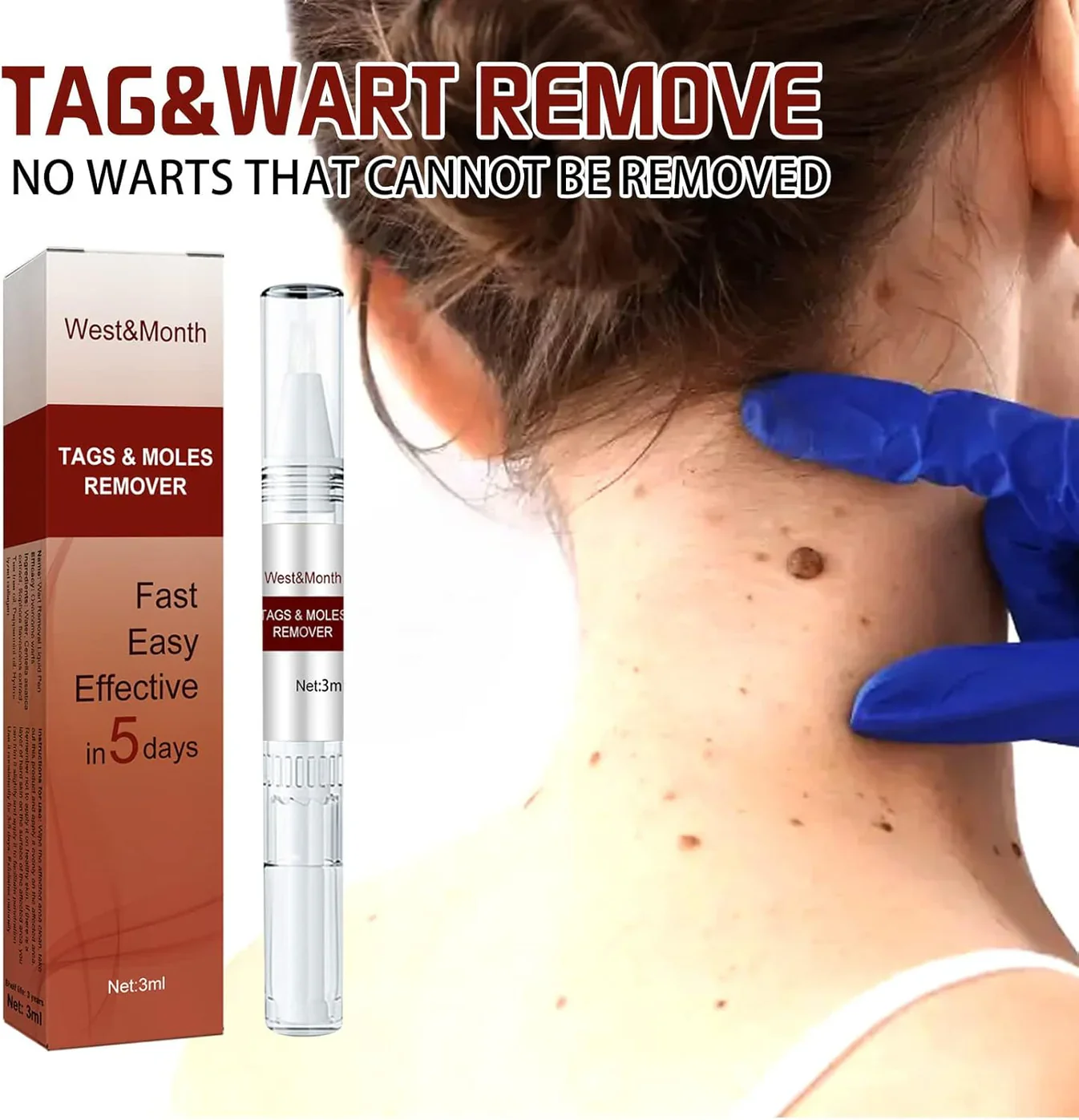 Jaysuing Liquid Wart Flat – Advanced Wart Remover for Face, Hands & Body (20ml)