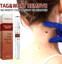 Jaysuing Liquid Wart Flat – Advanced Wart Remover for Face, Hands & Body (20ml)